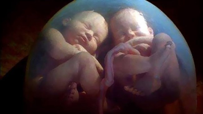 Life after delivery